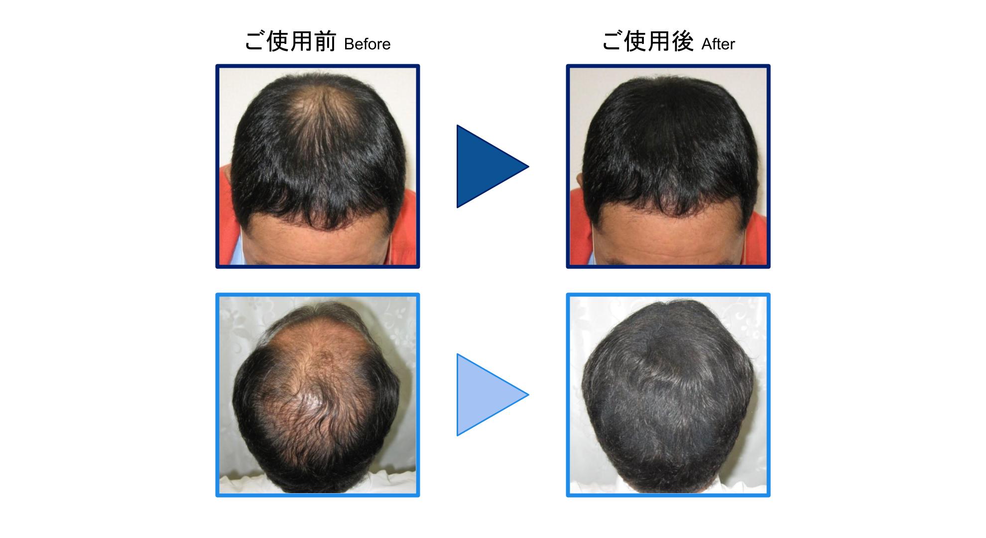 ティップトップのビフォーアフター